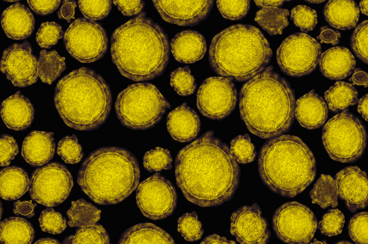 Sars-CoV-2 virus particles which cause Covid-19 under a microscope